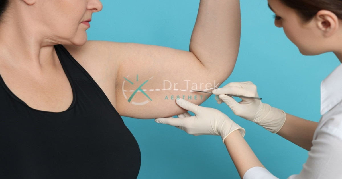 Arm Liposuction Before And After