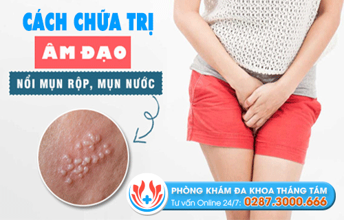 Điều trị âm đạo nổi mụn hiệu quả