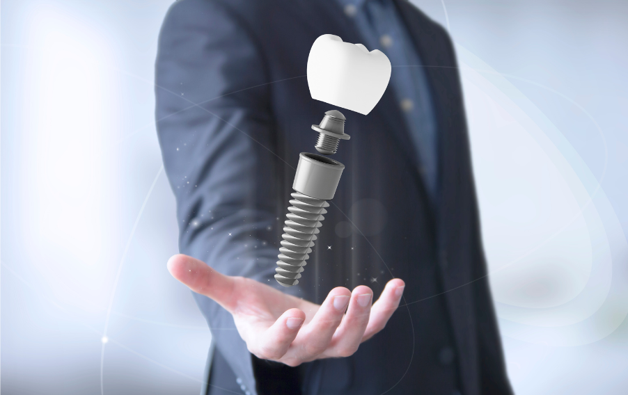 The best dental implant marketing for dentists