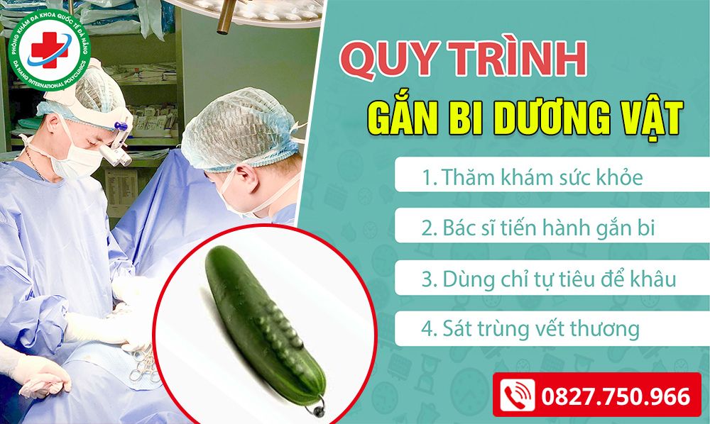 quy trình gắn bi dương vật ở đà nẵng