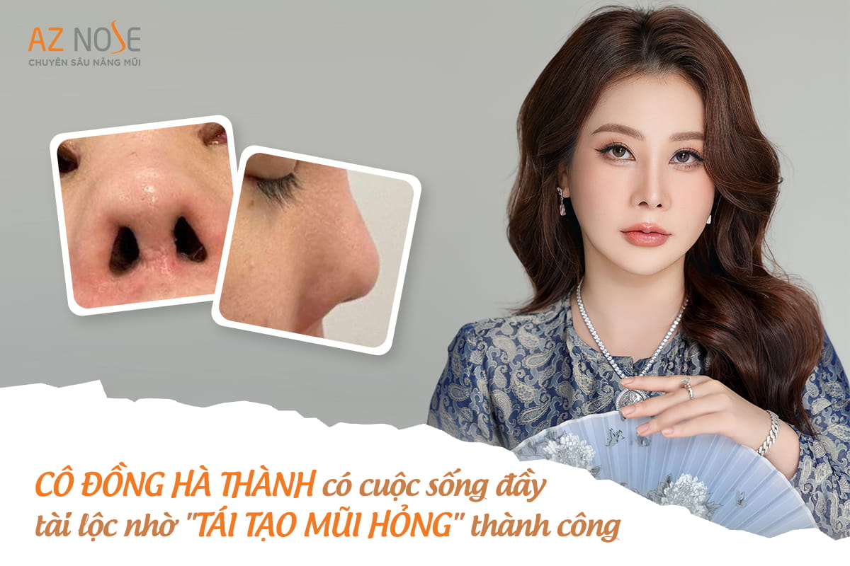 Sửa Mũi Hỏng: Cải Thiện Dáng Mũi và Tự Tin Hơn VgZ3mssXqNDbJldtJlcuuvRl5azwctN25oAcjTql74eT26Y31c968ayJkKr1H0qsZ2CvpC0Y_r91FtiaoqFUabDz8MVwK3MggvRpi59ckwXlzpMYZwaLLK3qujG4I2VpcgzZYXwmAbqPNhaJwwaLSho