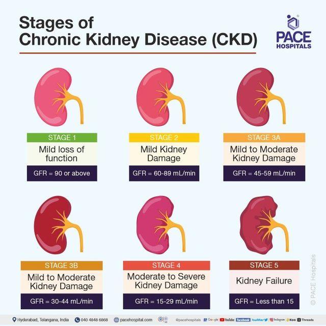 Chronic Kidney Disease - Symptoms, Stages, Causes, Risk Factors