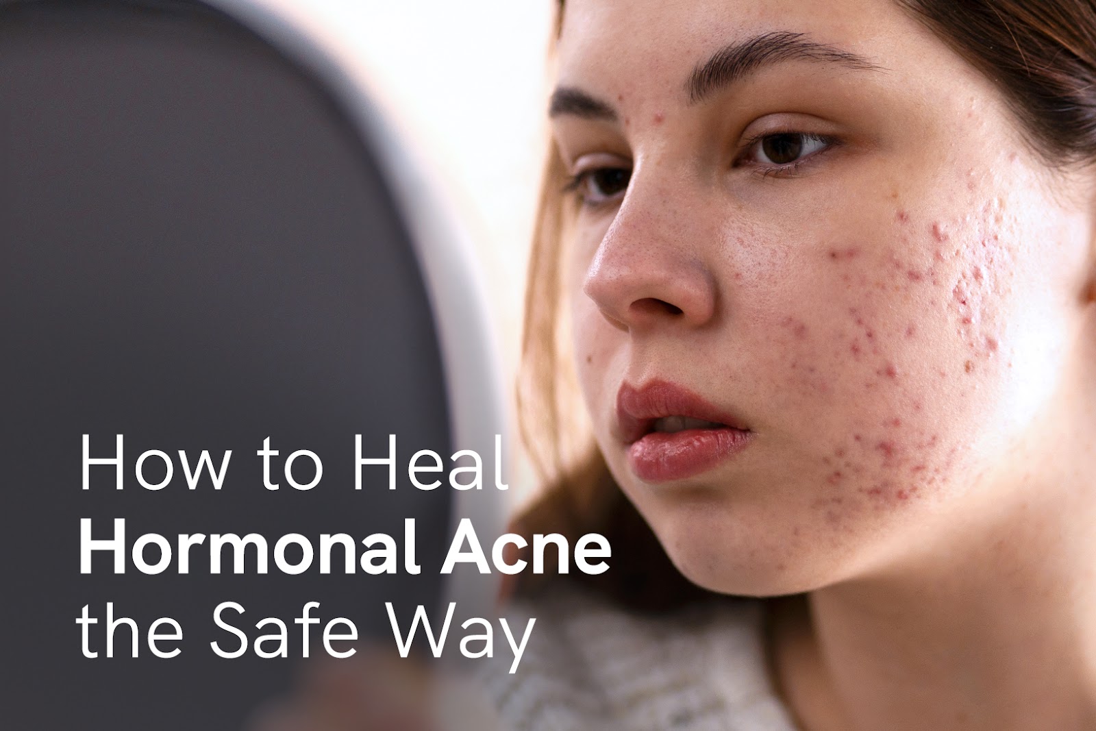 Get Clear Skin: Heal Hormonal Acne Holistically with the Flawless Twins
