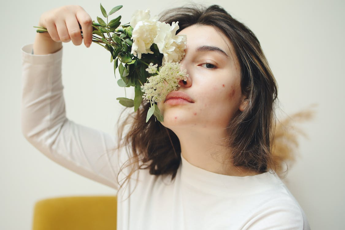 person with acne and flower over her face