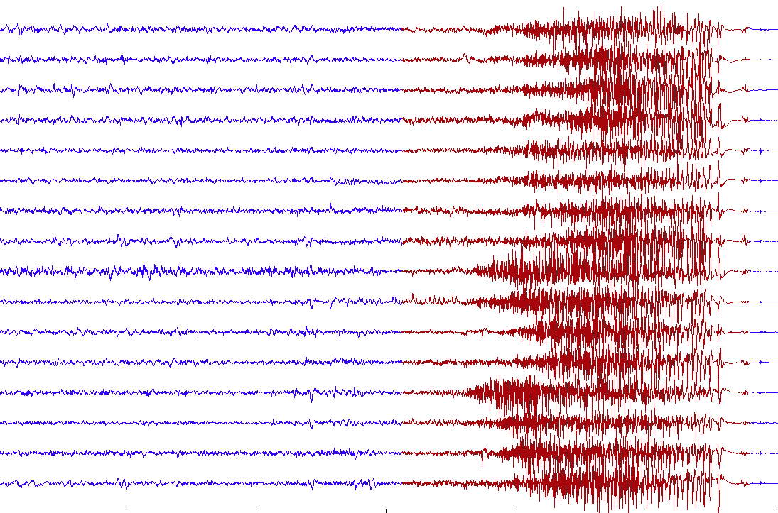 Ambulatory EEG recording from dog with epilepsy. Seizure shown in red.