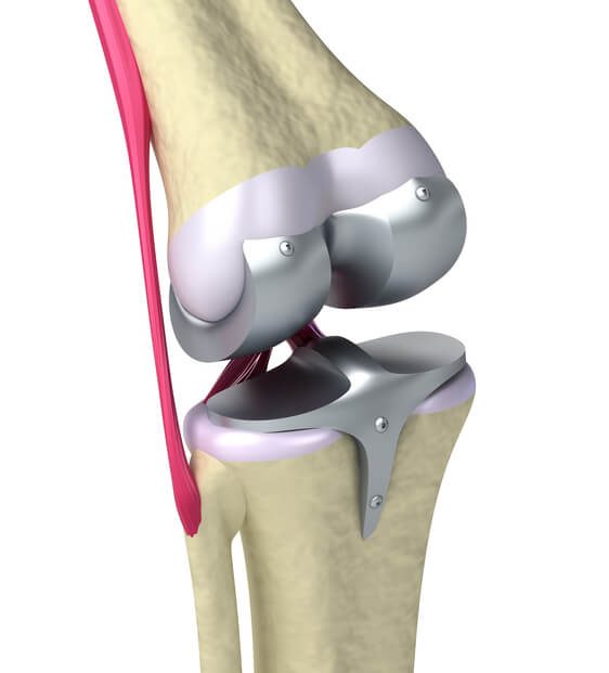 Medial Knee