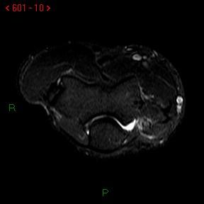 A close-up of a mri Description automatically generated