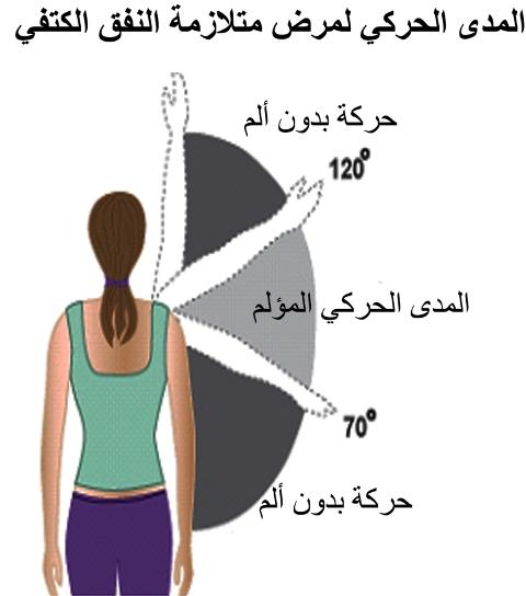 E:\Documents and Settings\USER\Desktop\كبار السن\impengement.jpg