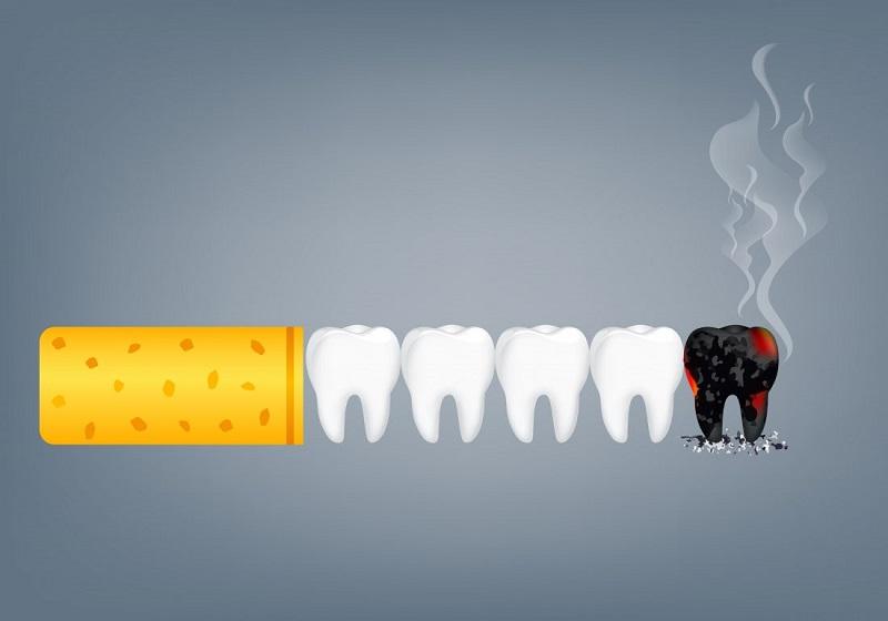 Can Smokers Get the Dental Implant?