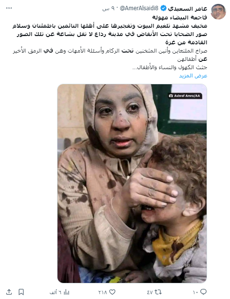 الادعاء بأن الصورة ليسيدة يمنية مصابة في البيضاء