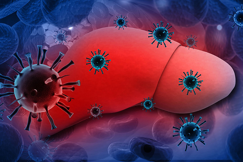 Viêm gan B là bệnh do virus HBV (Hepatitis B Virus) gây ra 