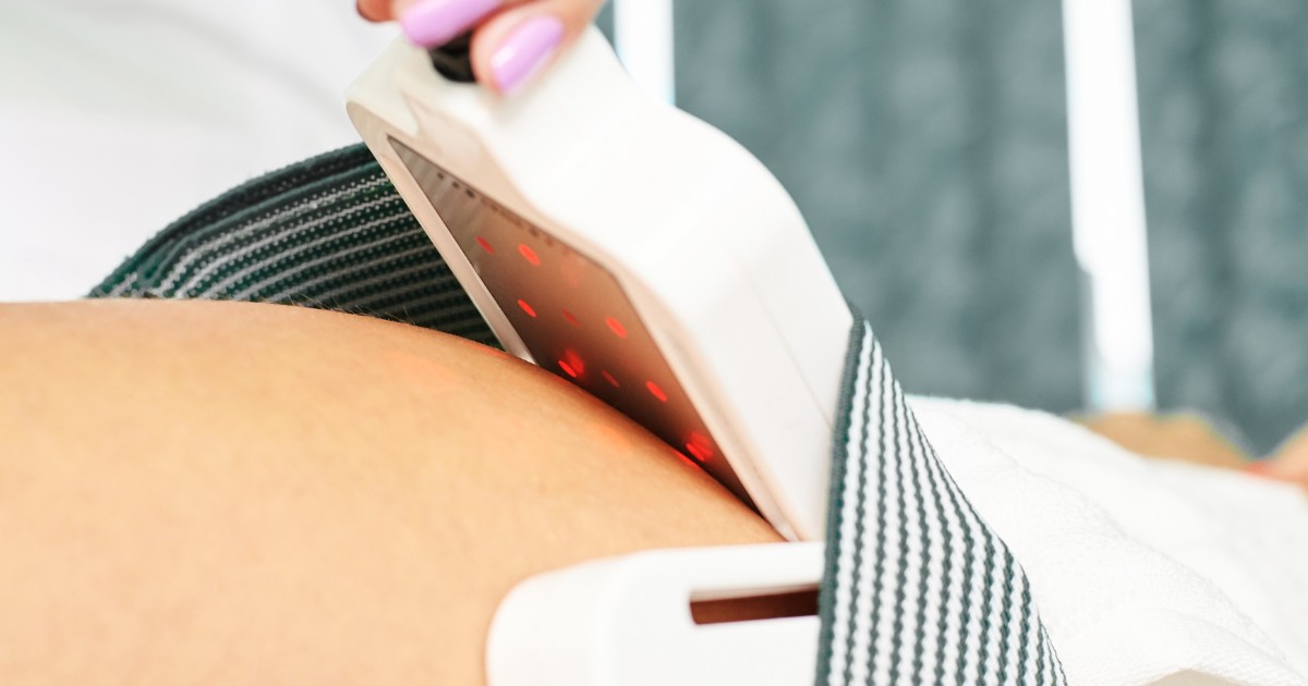 How Is Lipo Laser Done Liposuction