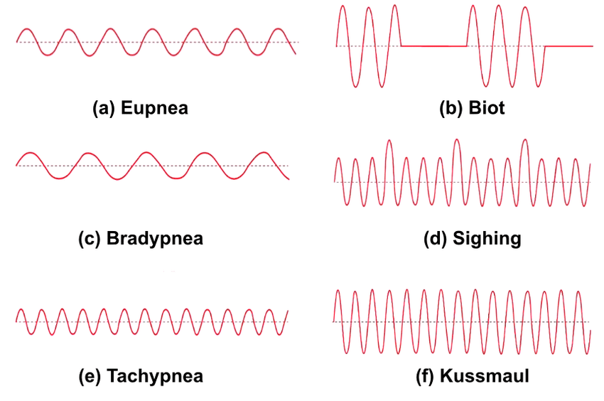 Sample plots of distinct human respiratory. | Download Scientific Diagram