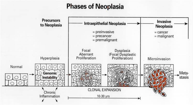 Principles of Neoplasia - Oncology - Medbullets Step 1