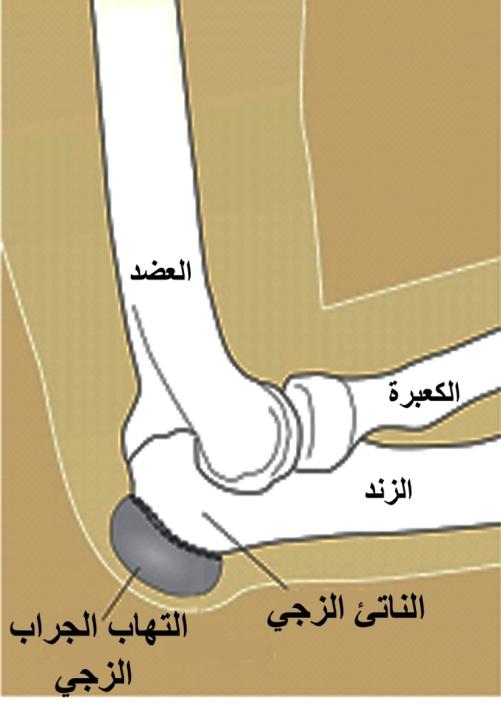 E:\Documents and Settings\USER\Desktop\كبار السن\اجزاء التهاب الجراب.jpg