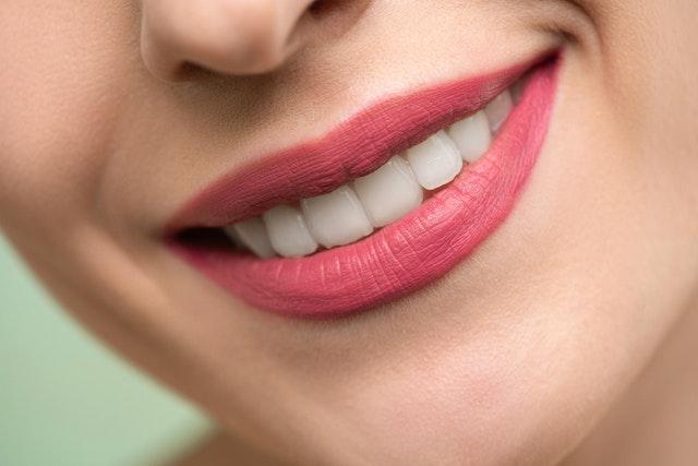 Close-up of a person's smile

Description automatically generated