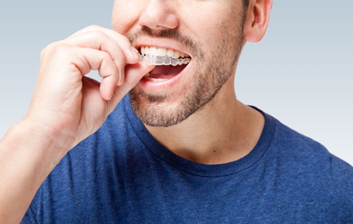 Invisalign Innovations: Embracing Advanced Technology for Orthodontic Care