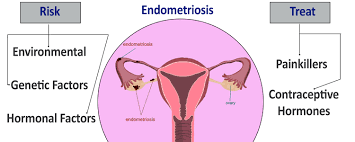 Endometriosis as female reproductive system disorder: mechanisms, diagnosis  and clinical management