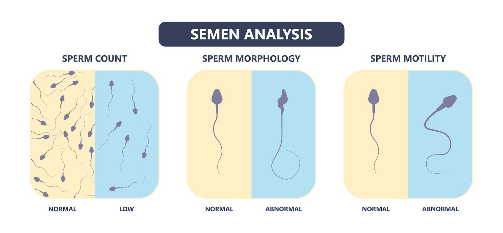 odber spermii