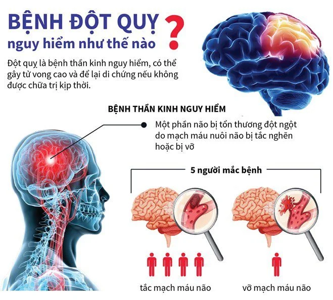 theo-doi-va-cham-soc-nguoi-bi-dot-quy