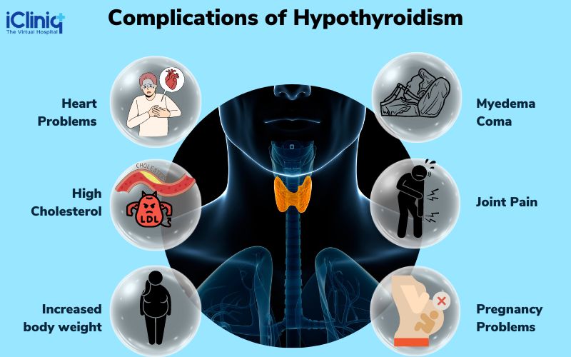 complications of hyperthyroidism