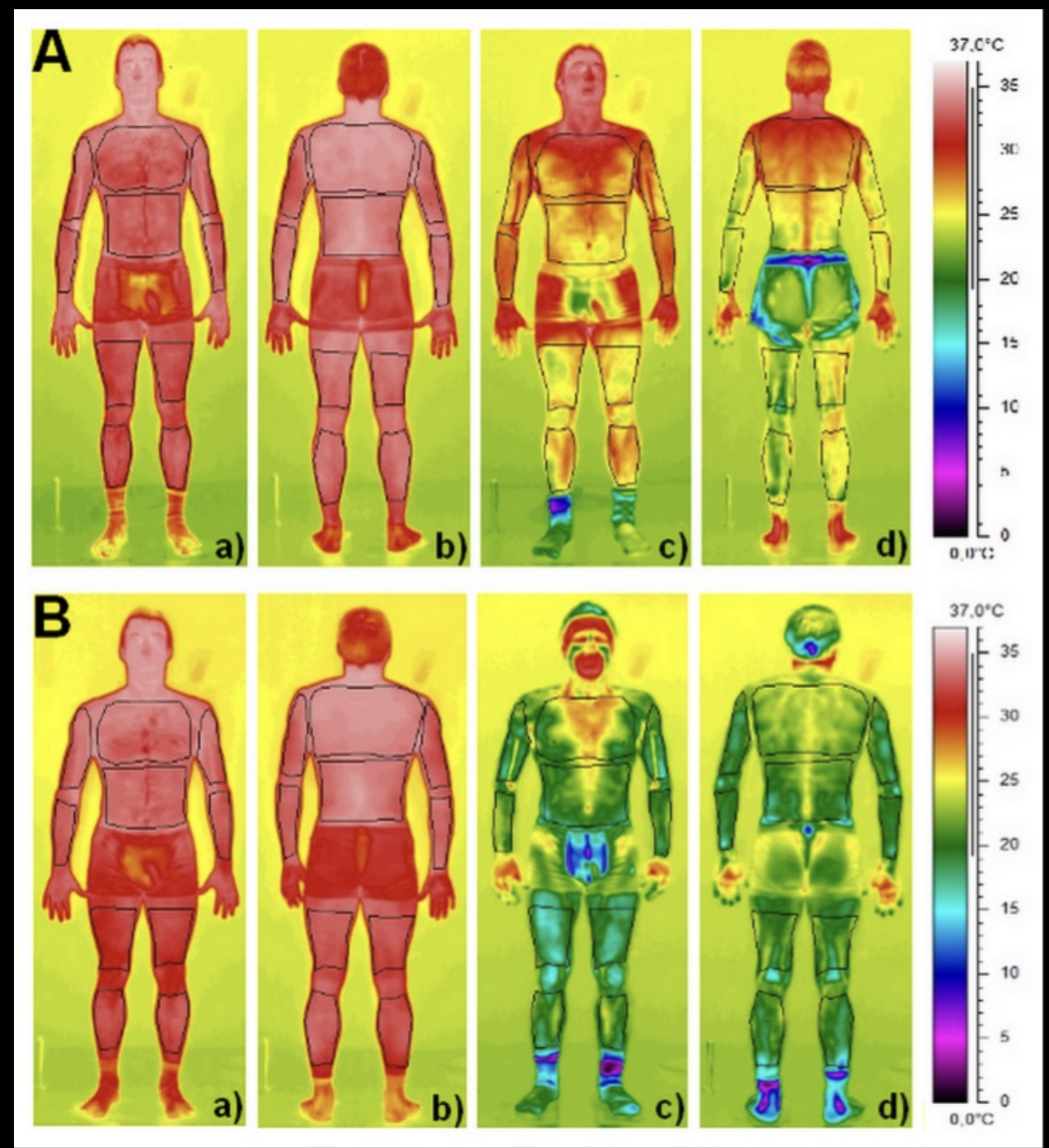 Graphic from pubmed study showing Whole Body Cryotherapy vs Partial Body Cryotherapy differences in skin temperature before and after