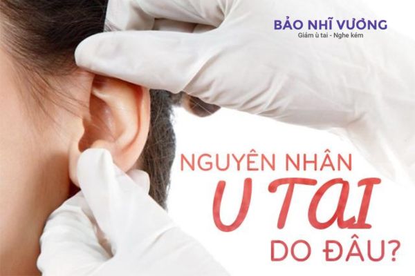 u-tai-nguyen-nhan