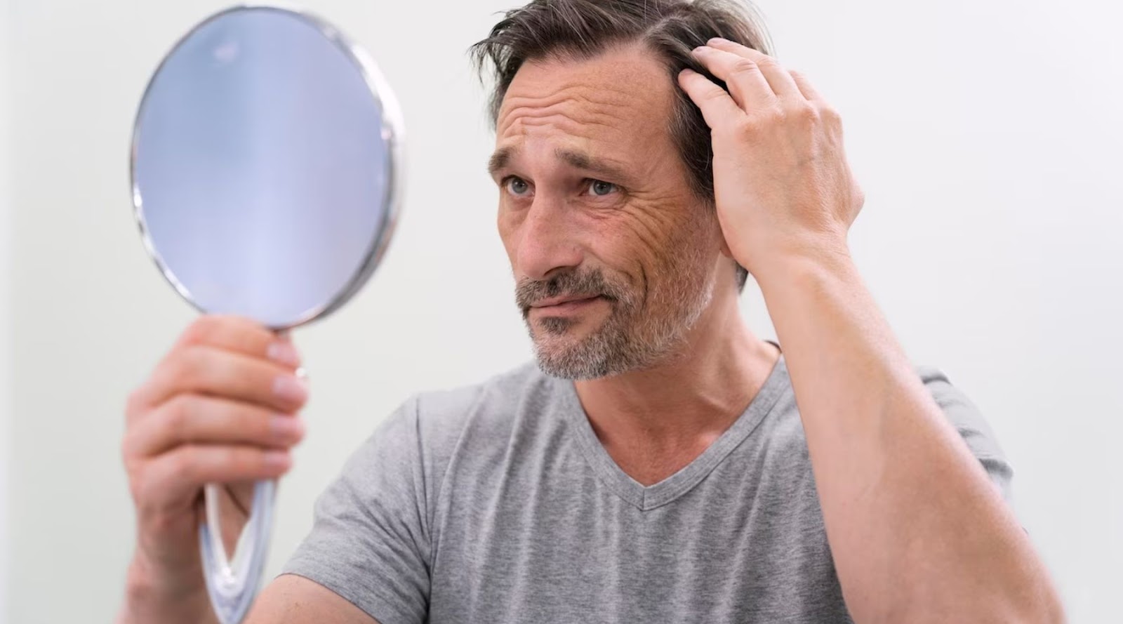Other Factors that Causes Hair Loss